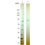 Human Transferrin Receptor/TFR1 N-terminal 6×His tag
